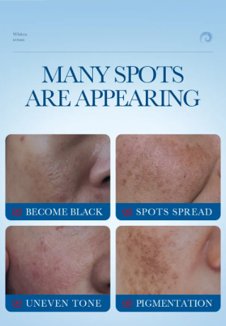 Sérum Antiedad Blanqueante con Colágeno (40ml) - Producto de alta calidad para tu hogar - Imagen 4