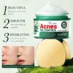Crema Facial Control del Acné con Aceite de Árbol de Té 50ml SADOER  Purifica, Calma y Regula el Exceso de Grasa - Producto de alta calidad para tu hogar