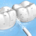 Irrigador Dental Wothident Fujos - Producto de alta calidad para tu hogar